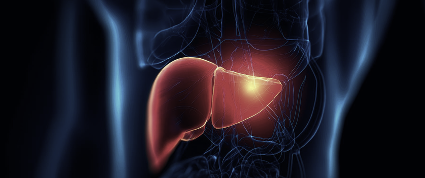 Fatty Liver Disease Causes, Symptoms, Diagnosis & Treatment Options-img-2