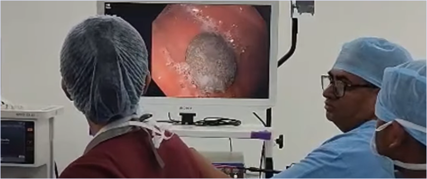 Diagnosis of Gastrointestinal Diseases at Lumen