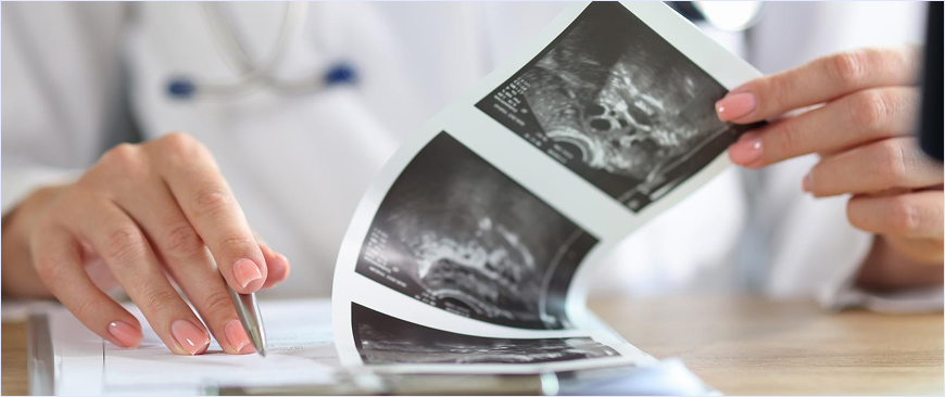 Diagnosis with FibroScan at Lumen