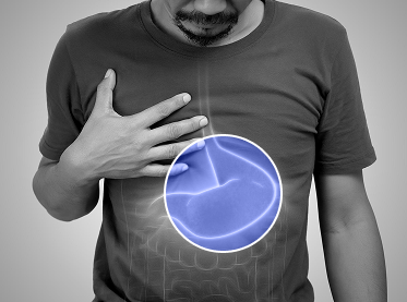 Gastrointestinal Diseases