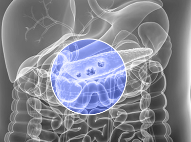 Pancreatic Disease